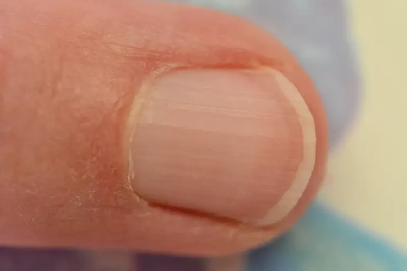 image from Fingernail Meditation