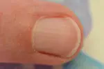Fingernail Meditation