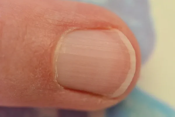 Fingernail Meditation