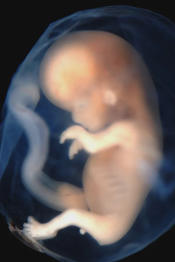 Buddhism and Abortion