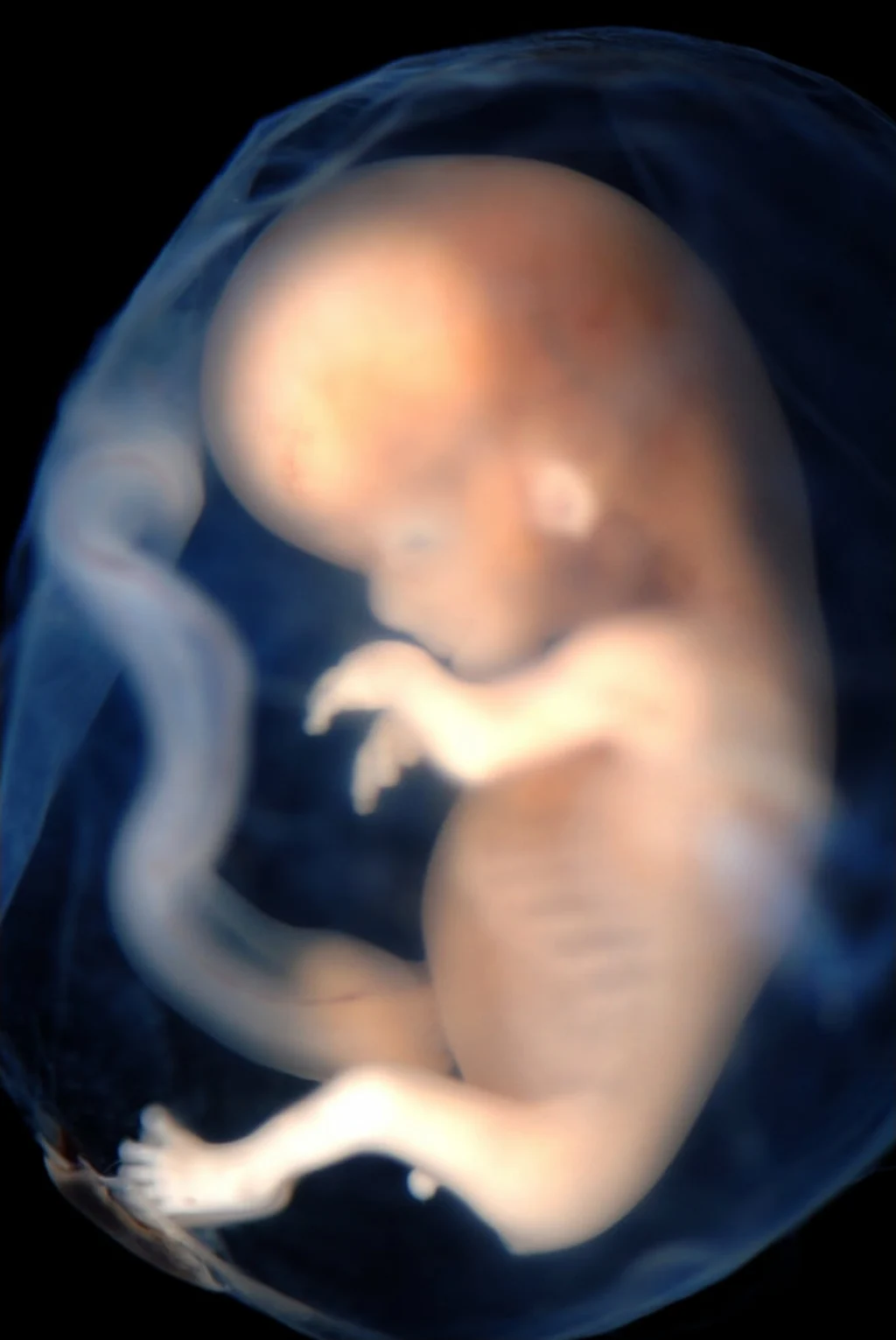 image from Buddhism and Abortion